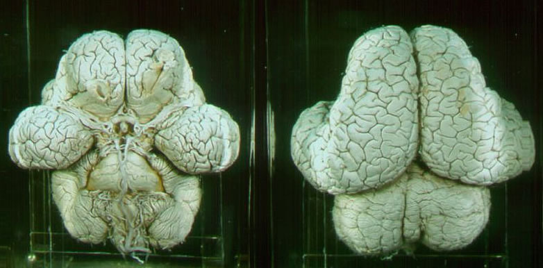 Gehirn eines Elefanten